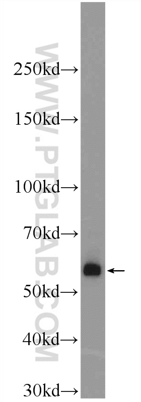 WB analysis of human skeletal muscle using 12702-1-AP