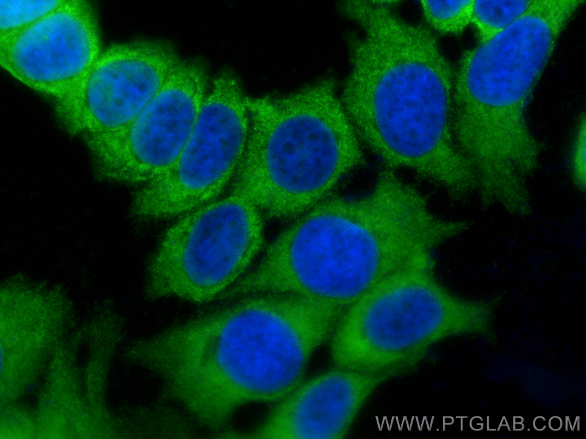 IF Staining of MCF-7 using 26696-1-AP