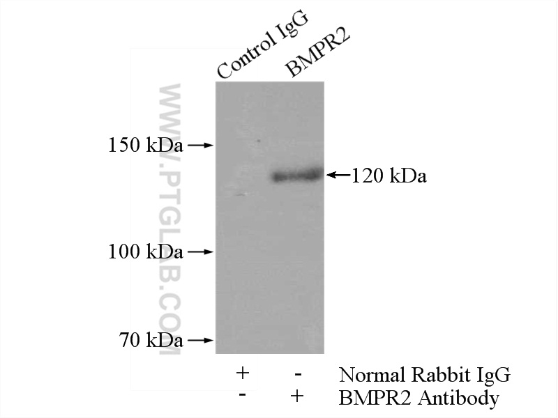 IP experiment of mouse brain using 19087-1-AP