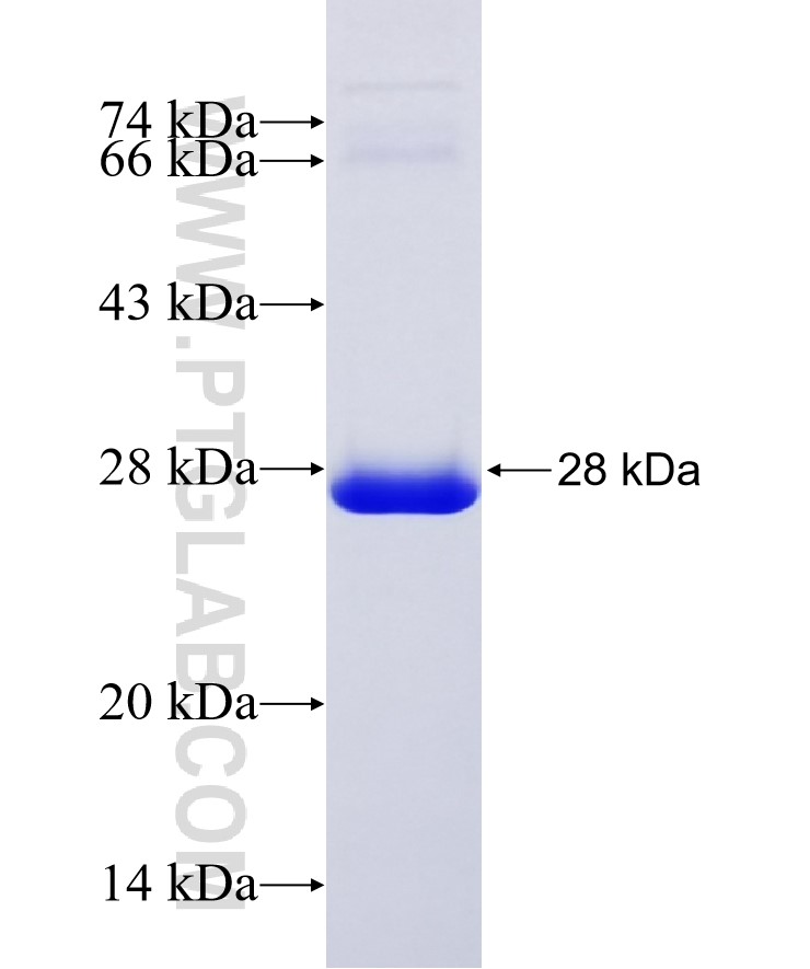 BMX fusion protein Ag26419 SDS-PAGE