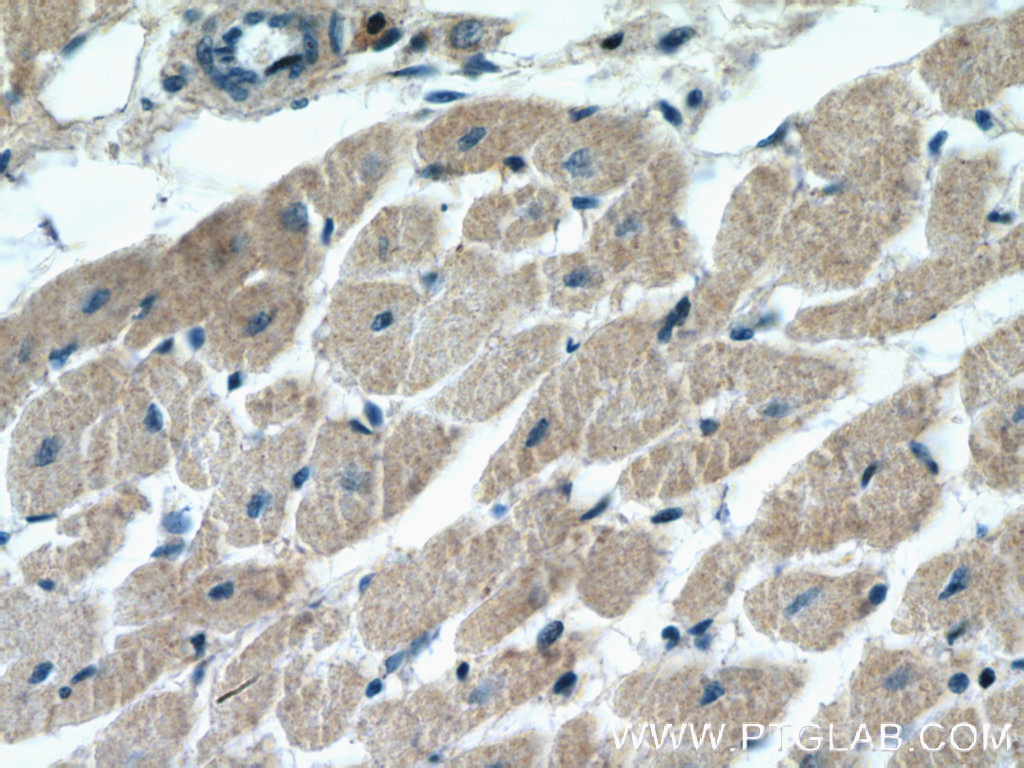 IHC staining of human heart using 15964-1-AP (same clone as 15964-1-PBS)