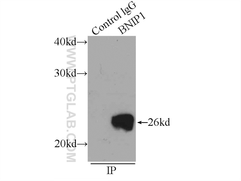 IP experiment of mouse brain using 15964-1-AP (same clone as 15964-1-PBS)