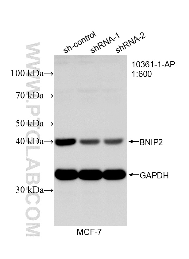 WB analysis of MCF-7 using 10361-1-AP (same clone as 10361-1-PBS) WB analysis of MCF-7 using 10361-1-AP (same clone as 10361-1-PBS)