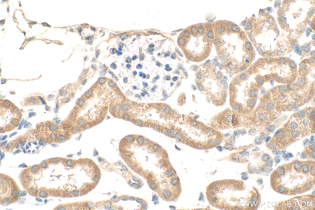 IHC staining of mouse kidney using 68091-1-Ig