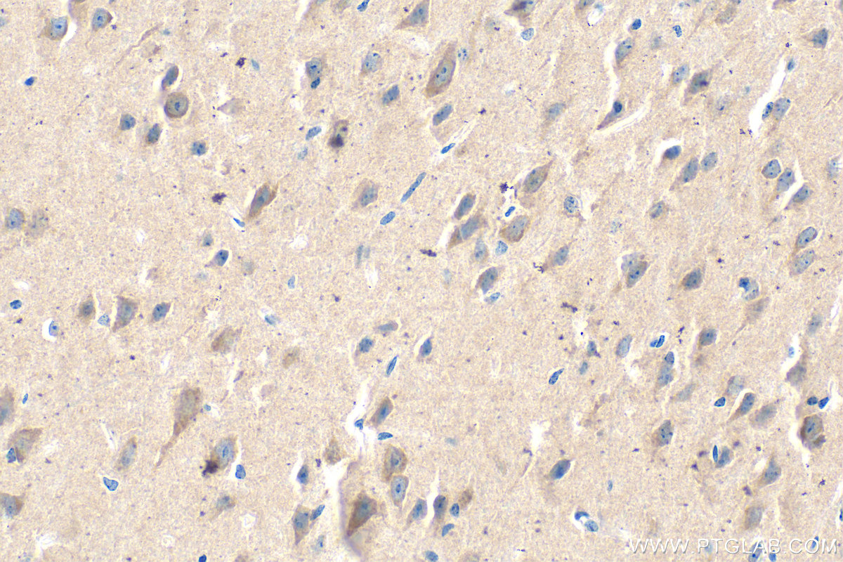 IHC staining of mouse brain using 68091-1-Ig