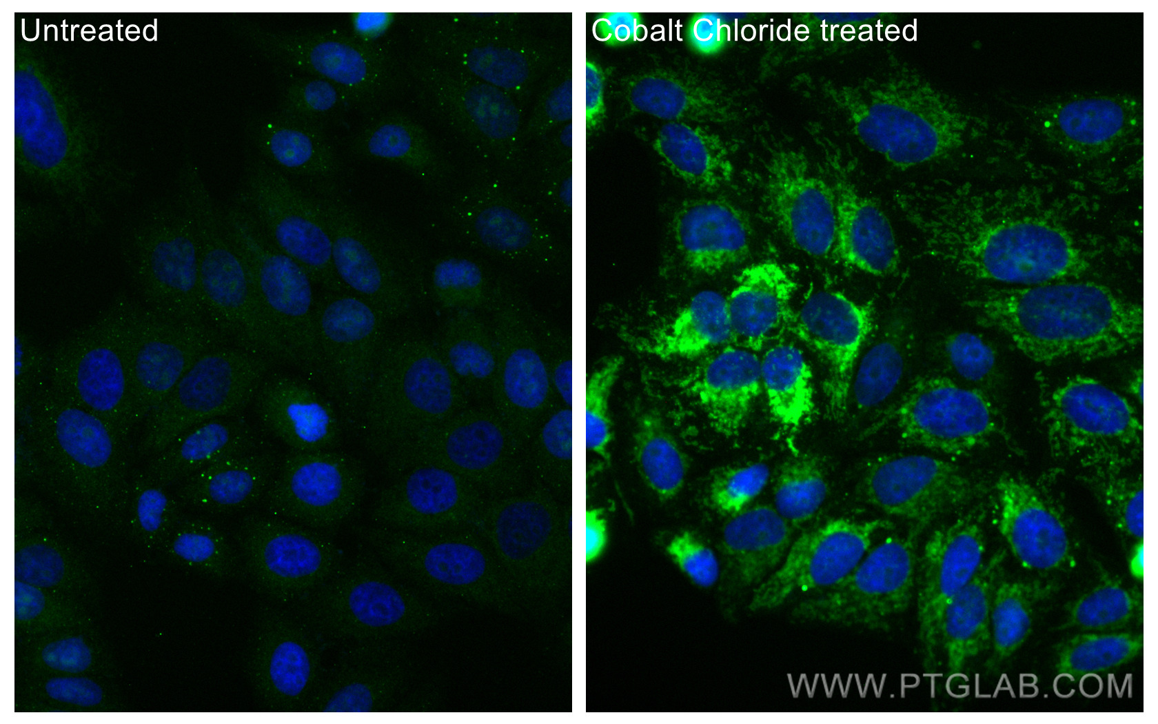 IF Staining of HepG2 using CL488-68091