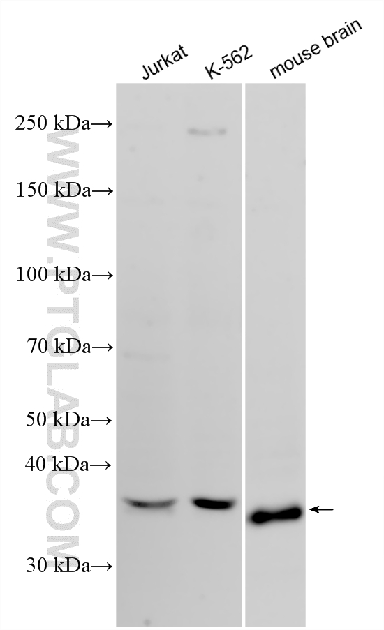 Various lysates were subjected to SDS PAGE followed by western blot with 29848-1-AP (BNIP3L antibody) at dilution of 1:500 incubated at room temperature for 1.5 hours. WB analysis using 29848-1-AP