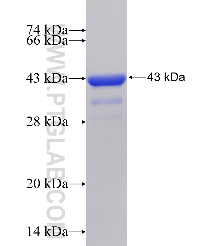 BNIP3L fusion protein Ag31514 SDS-PAGE