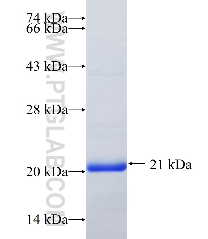 BNP fusion protein Ag36875 SDS-PAGE BNP fusion protein Ag36875 SDS-PAGE