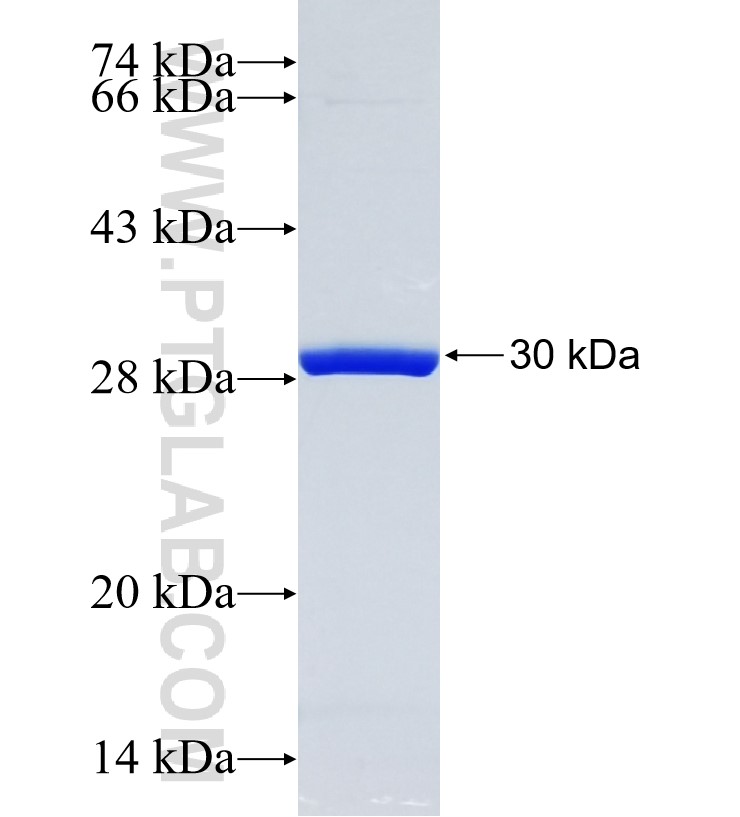 BOD1 fusion protein Ag23908 SDS-PAGE BOD1 fusion protein Ag23908 SDS-PAGE