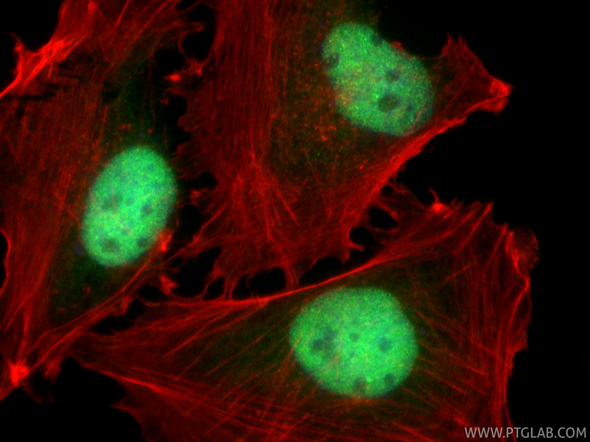 IF Staining of U-251 using 31560-1-AP (same clone as 31560-1-PBS)