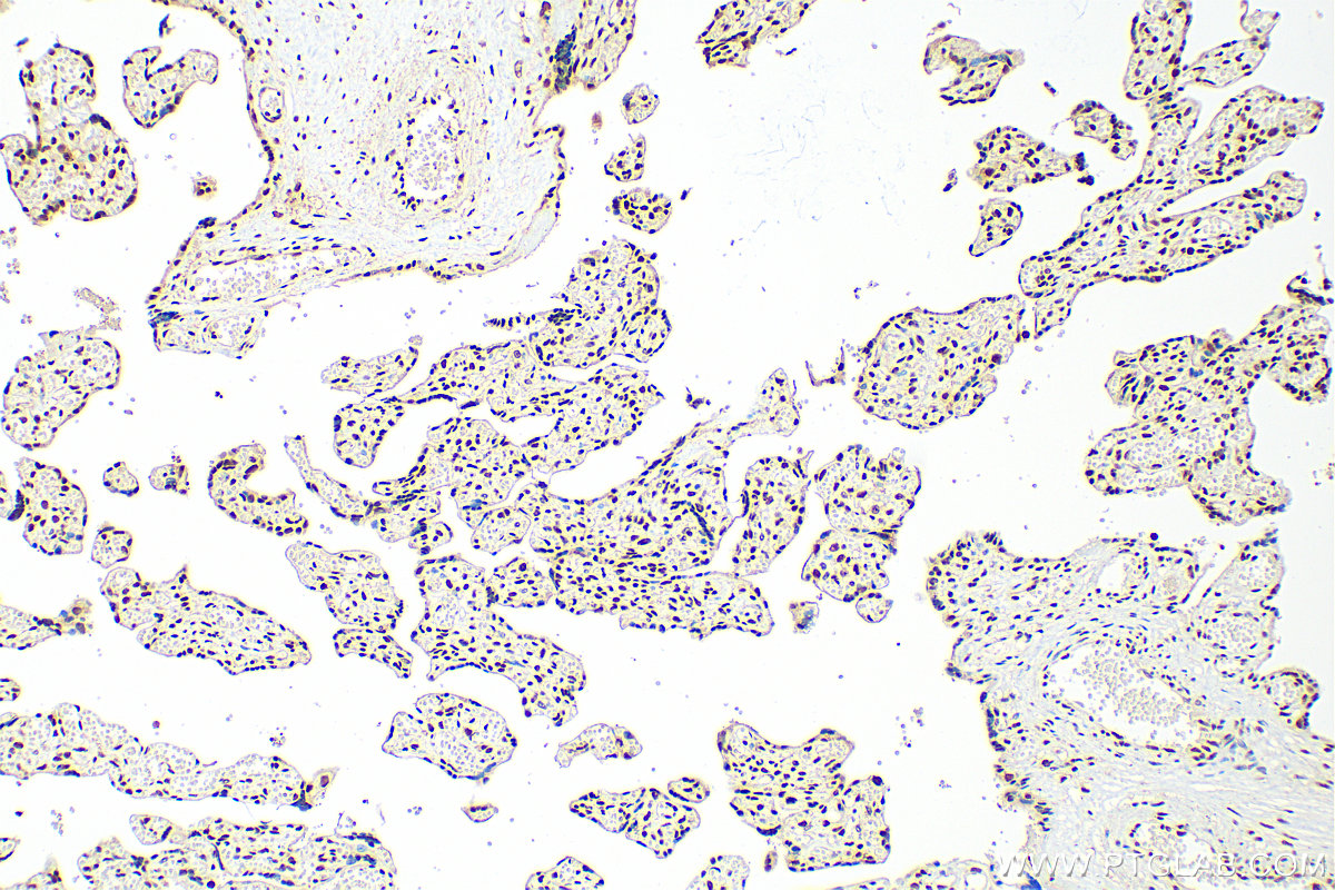 IHC staining of human placenta using 31560-1-AP