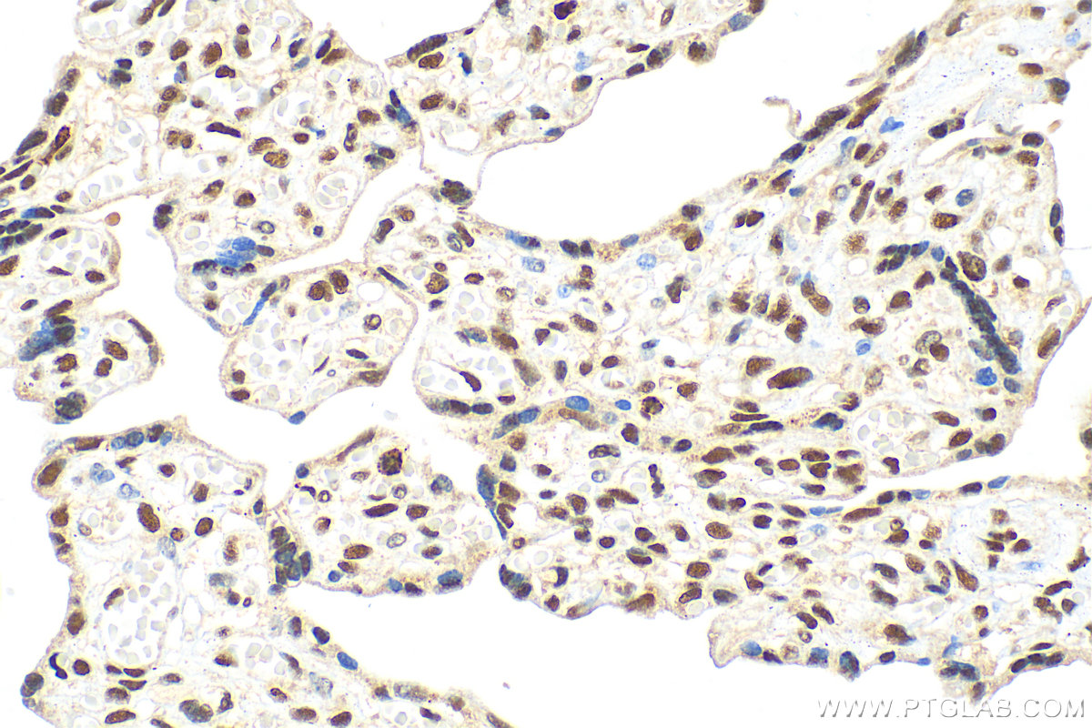 IHC staining of human placenta using 31560-1-AP