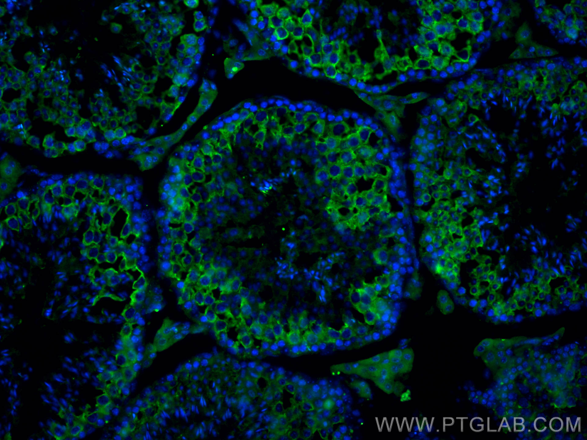 IF Staining of mouse testis using 13720-1-AP