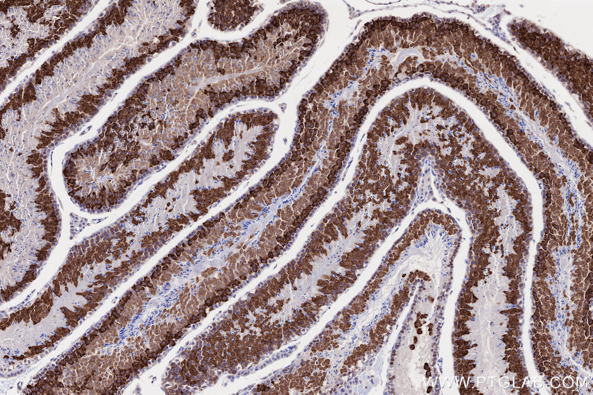 IHC staining of mouse testis using 13720-1-AP