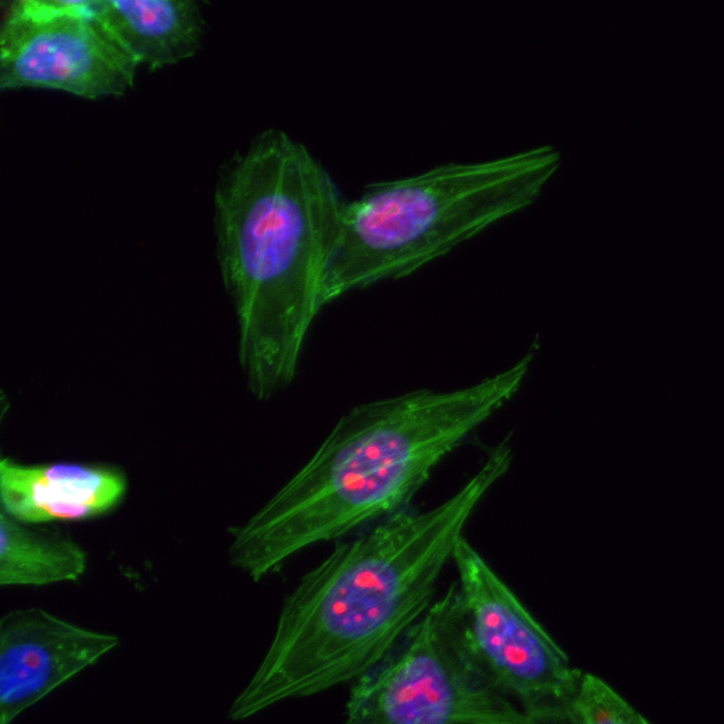 IF Staining of HepG2 using 82742-3-RR (same clone as 82742-3-PBS)