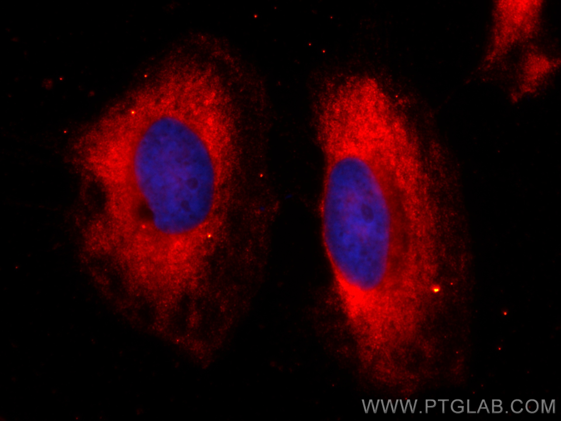 IF Staining of HeLa using CL594-60079