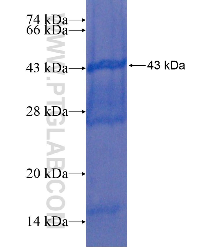 BORIS fusion protein Ag17551 SDS-PAGE BORIS fusion protein Ag17551 SDS-PAGE