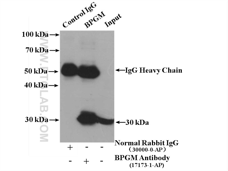 IP experiment of mouse liver using 17173-1-AP