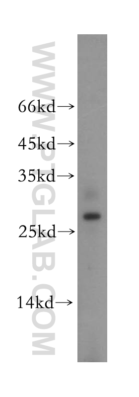 WB analysis of human kidney using 17974-1-AP