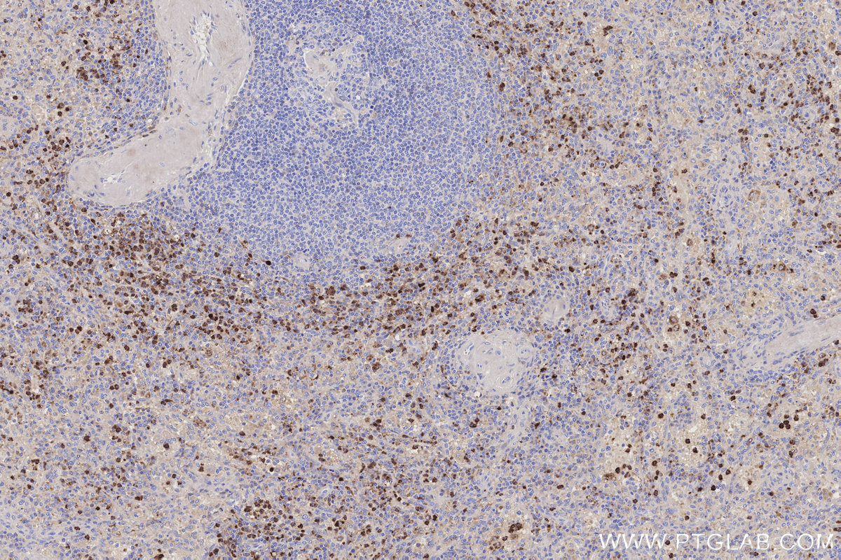 IHC staining of human spleen using 14368-1-AP IHC staining of human spleen using 14368-1-AP