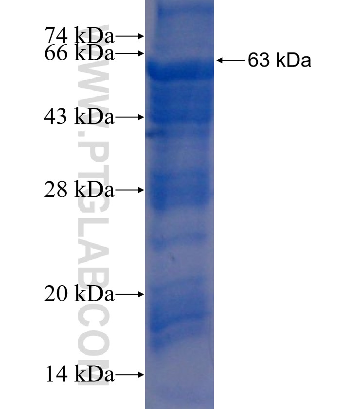 BPI fusion protein Ag5695 SDS-PAGE
