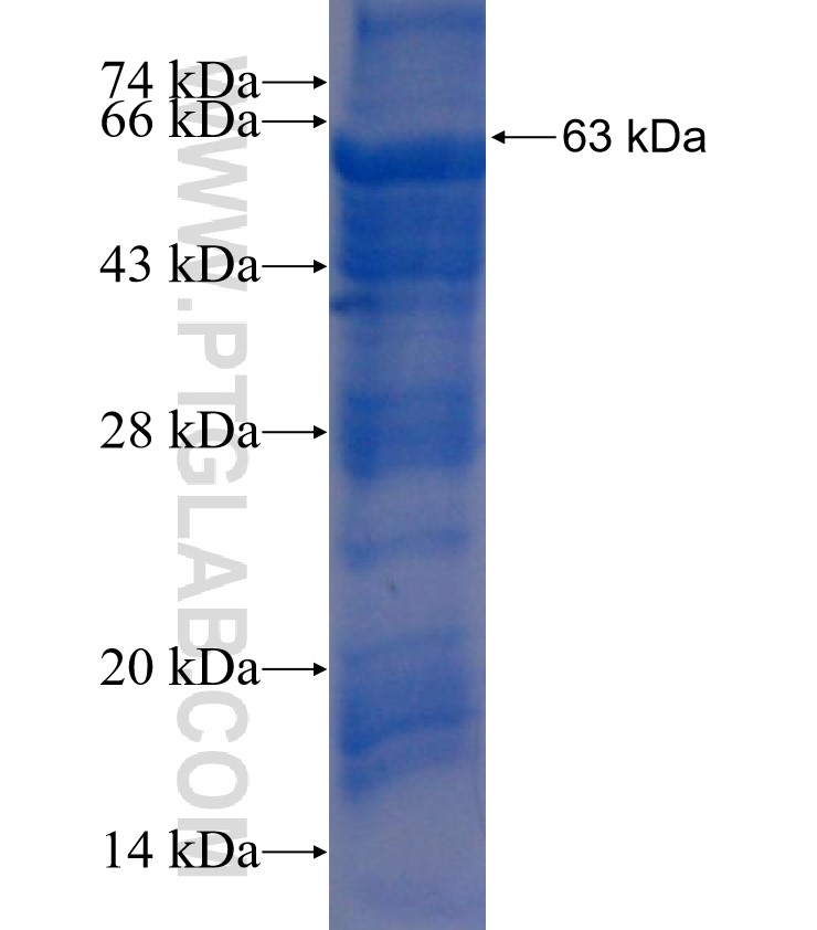 BPI fusion protein Ag5695 SDS-PAGE