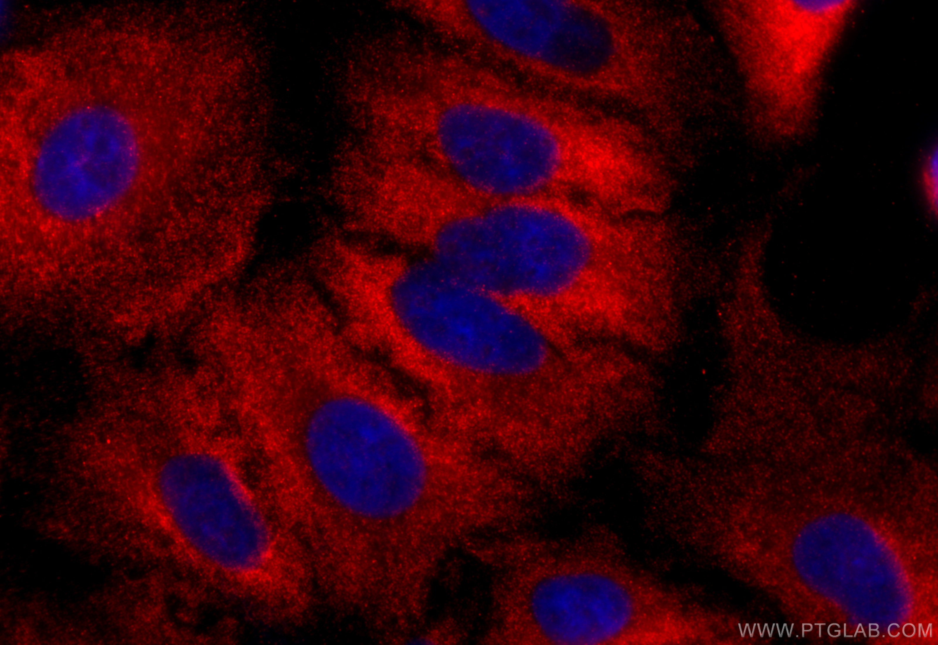 IF Staining of A549 using 13461-2-AP