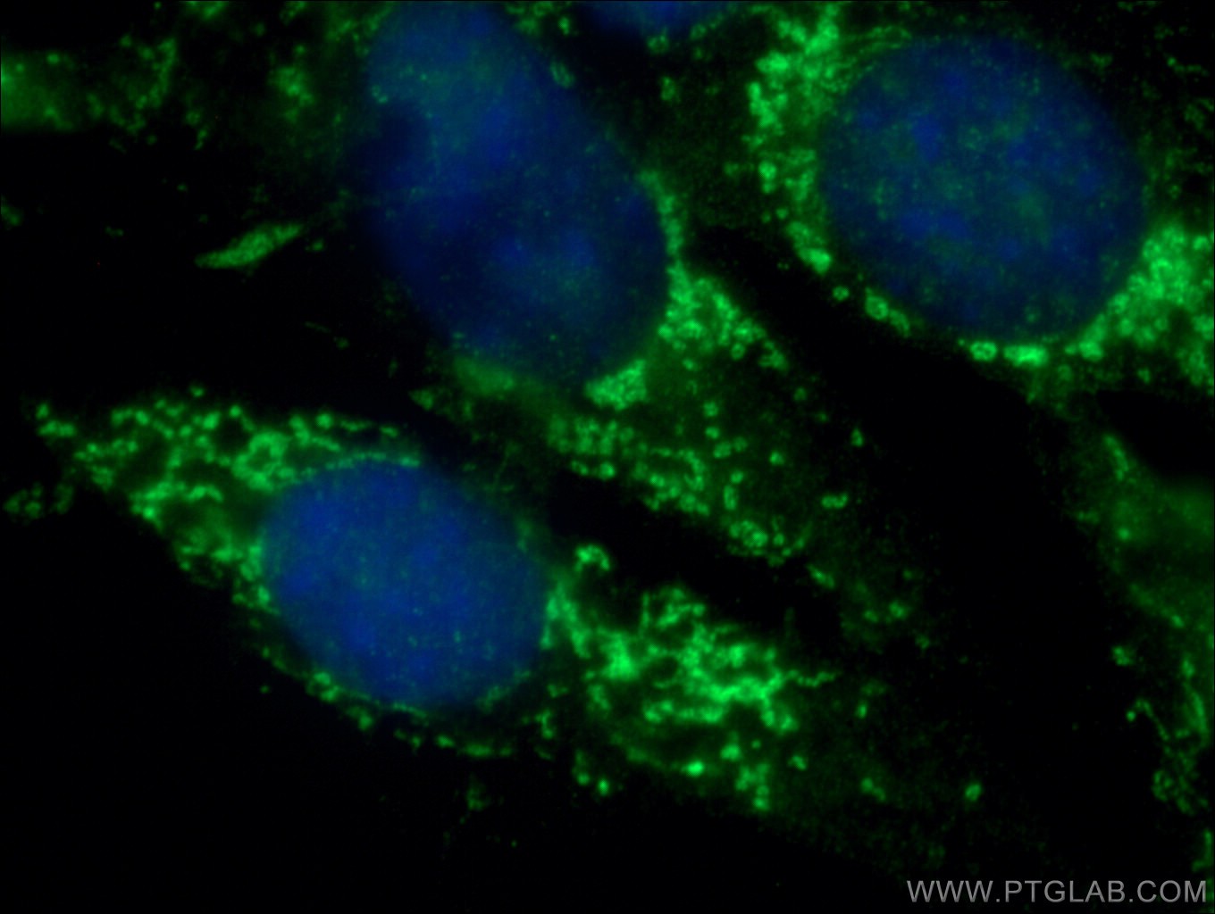 IF Staining of NIH/3T3 using 20899-1-AP