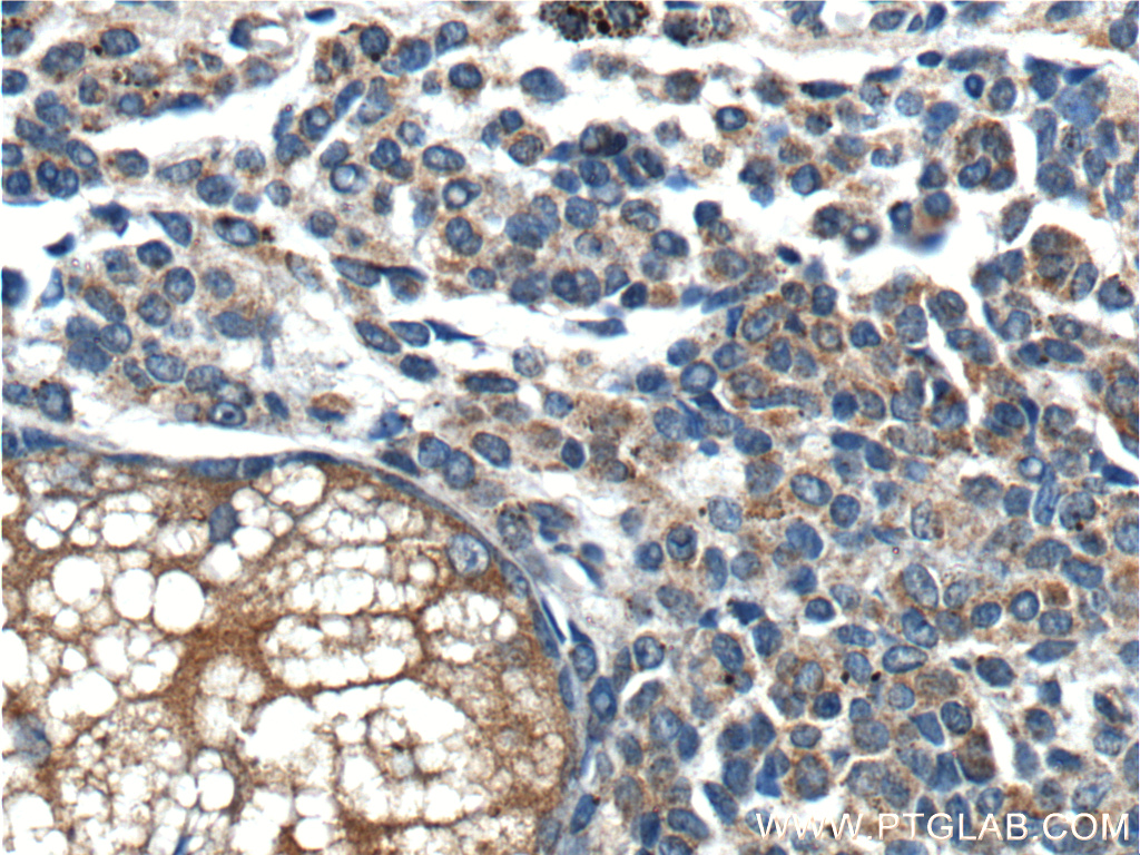 BRAF Polyclonal antibody