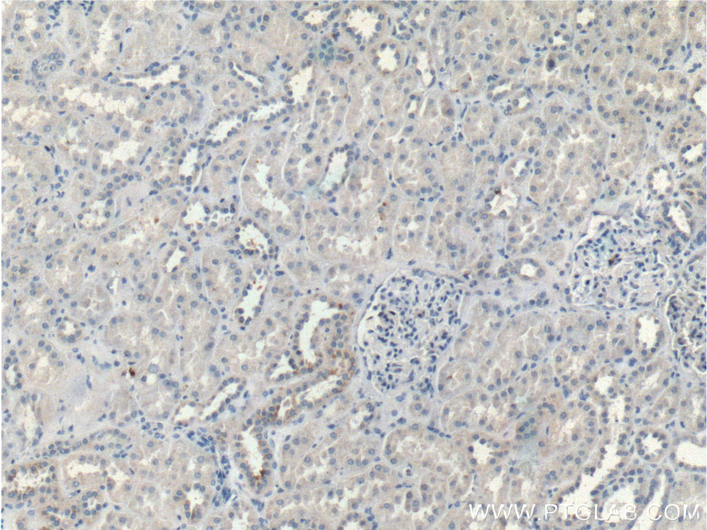 IHC staining of human kidney using 26004-1-AP