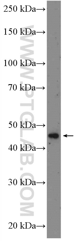 WB analysis of MCF-7 using 26004-1-AP