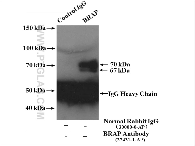 IP experiment of MCF-7 using 27431-1-AP