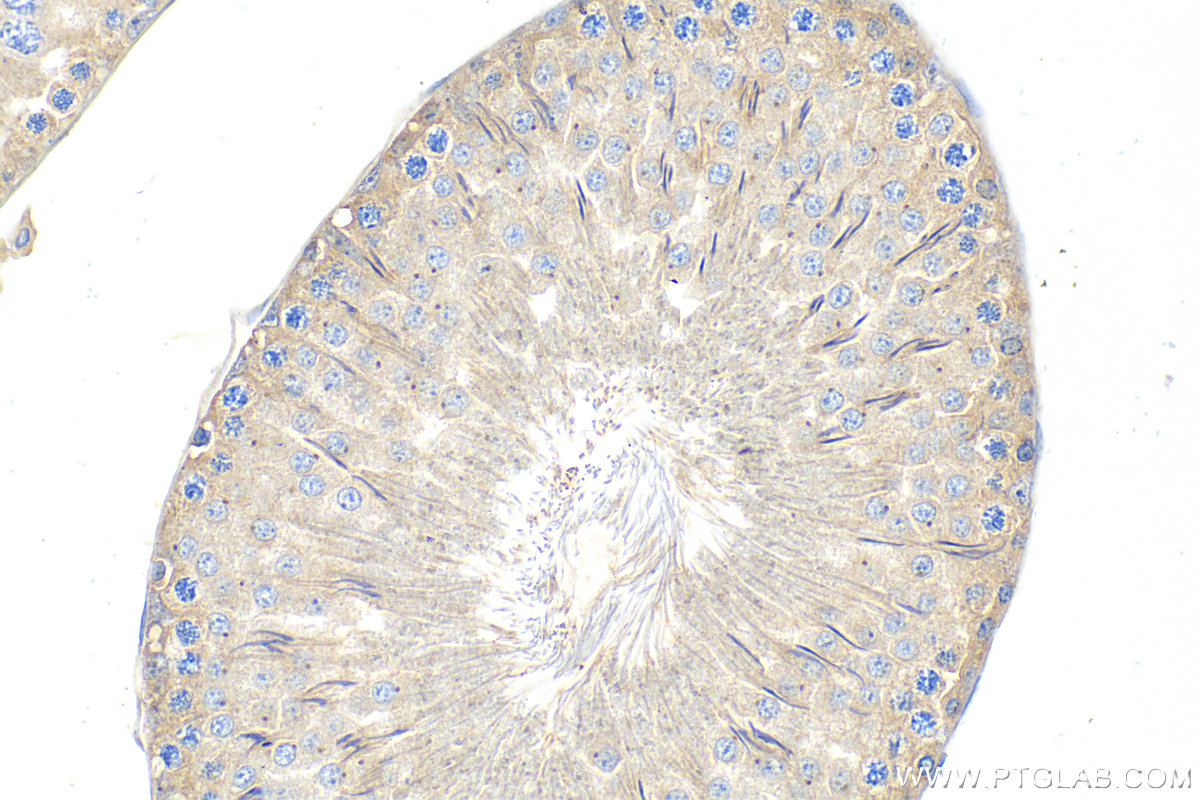 IHC staining of rat testis using 22362-1-AP