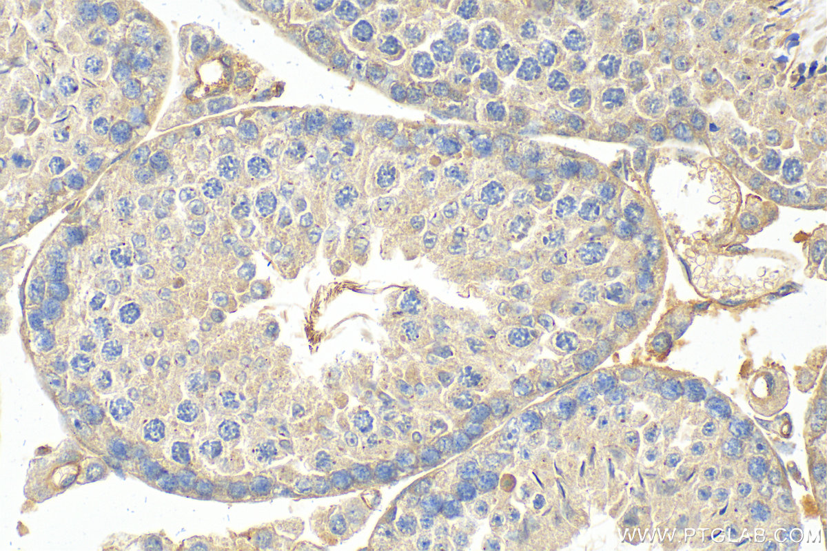IHC staining of mouse testis using 22362-1-AP