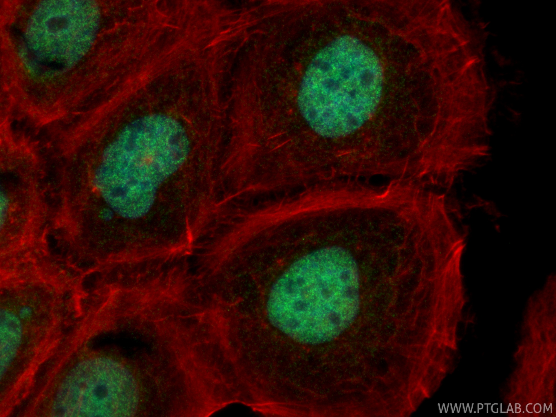 IF Staining of A431 using 32452-1-AP IF Staining of A431 using 32452-1-AP