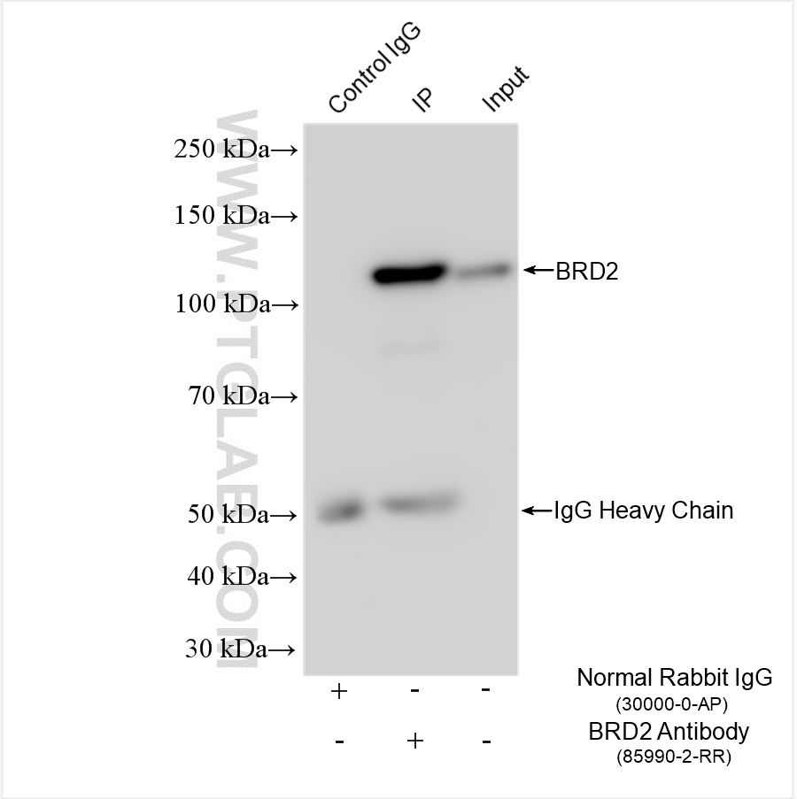 IP experiment of HeLa using 85990-2-RR (same clone as 85990-2-PBS)