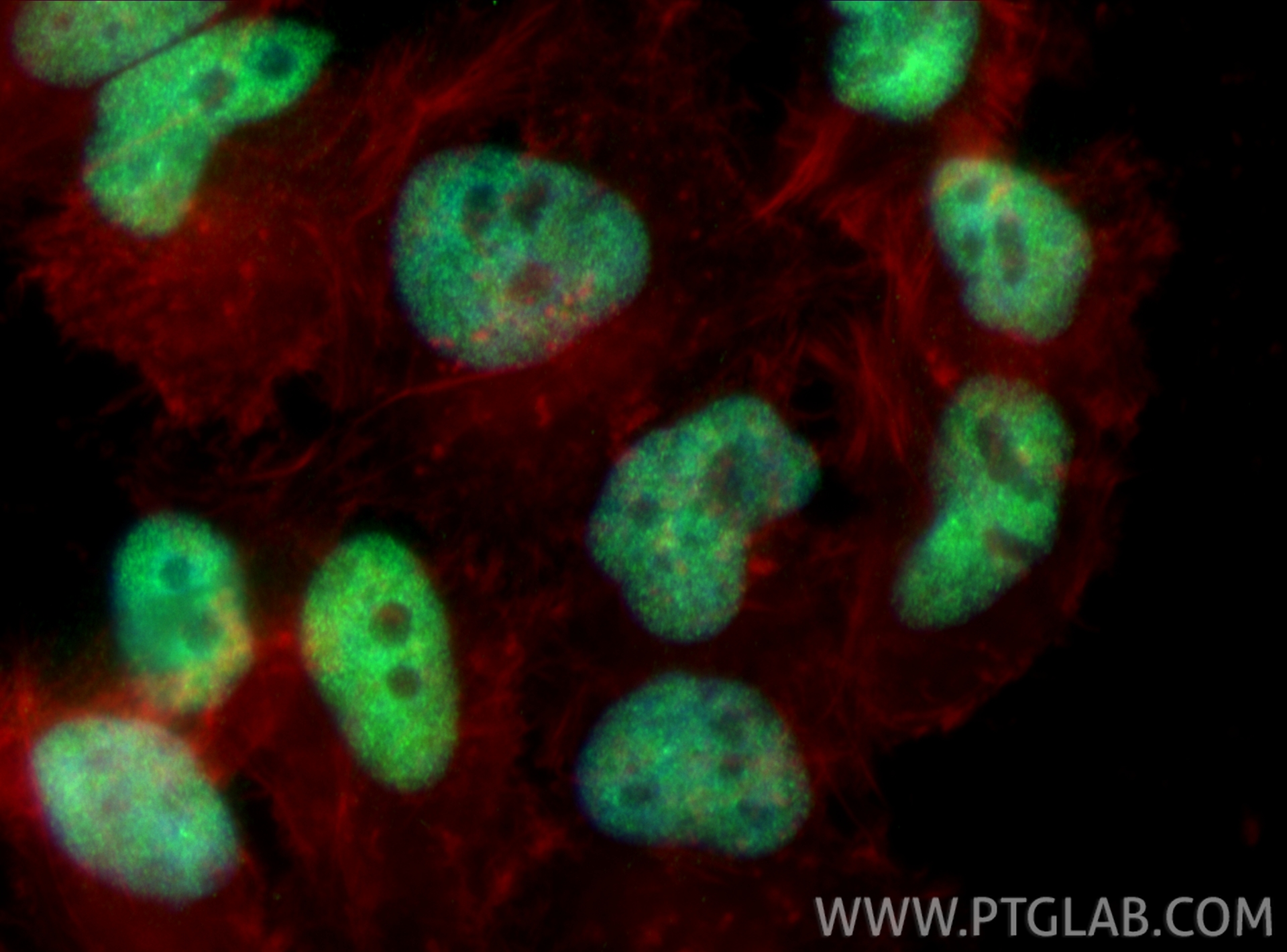 IF Staining of HeLa using RMX00117 IF Staining of HeLa using RMX00117