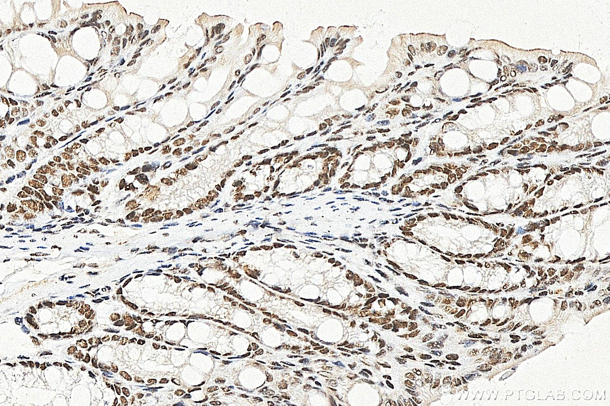 IHC staining of mouse colon using RMX00117 IHC staining of mouse colon using RMX00117