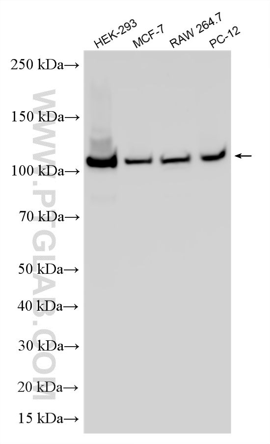 WB analysis using RMX00117 WB analysis using RMX00117