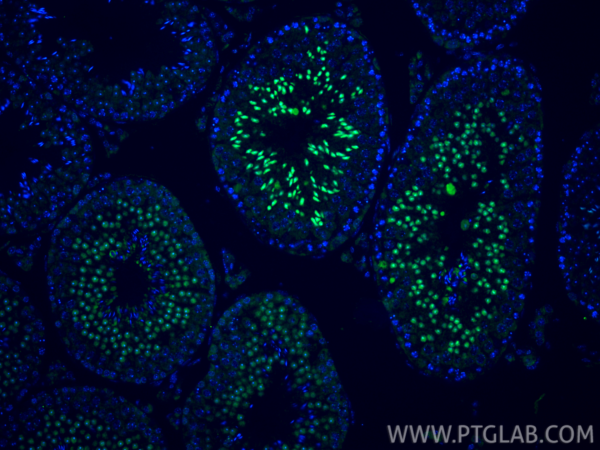 Immunofluorescent analysis of (4% PFA) fixed paraffin-embedded mouse testis tissue using BRD3 antibody (11859-1-AP) at dilution of 1:400 and CoraLite®488-Conjugated Goat Anti-Rabbit IgG(H+L) (<a class='green' href='/productredirect?CatalogNo=SA00013-2' target='_blank'>SA00013-2</a>). Heat mediated antigen retrieval with Tris-EDTA buffer (pH 9.0). IF Staining of mouse testis using 11859-1-AP