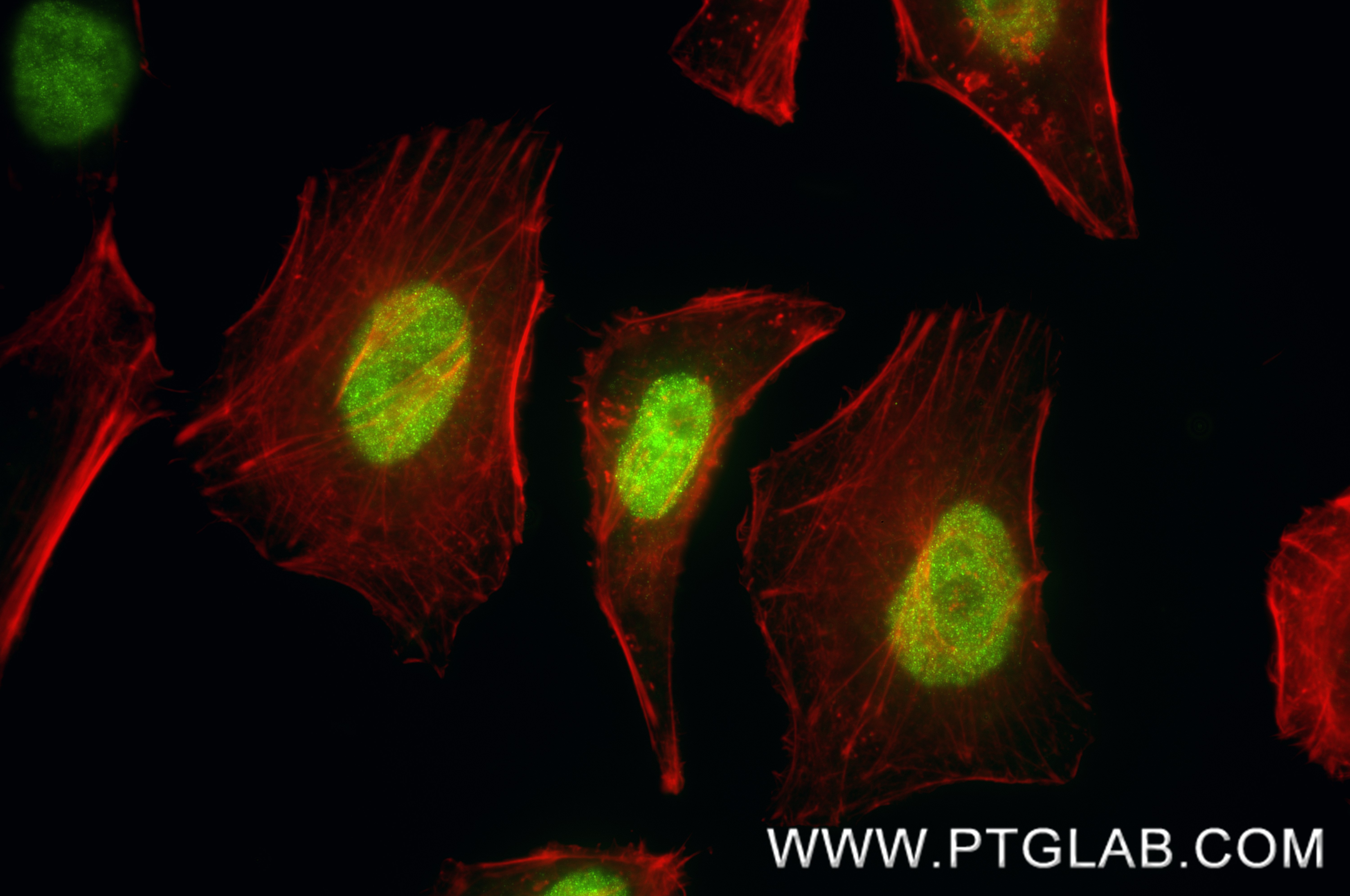 IF Staining of HeLa using 87030-5-RR (same clone as 87030-5-PBS) IF Staining of HeLa using 87030-5-RR (same clone as 87030-5-PBS)