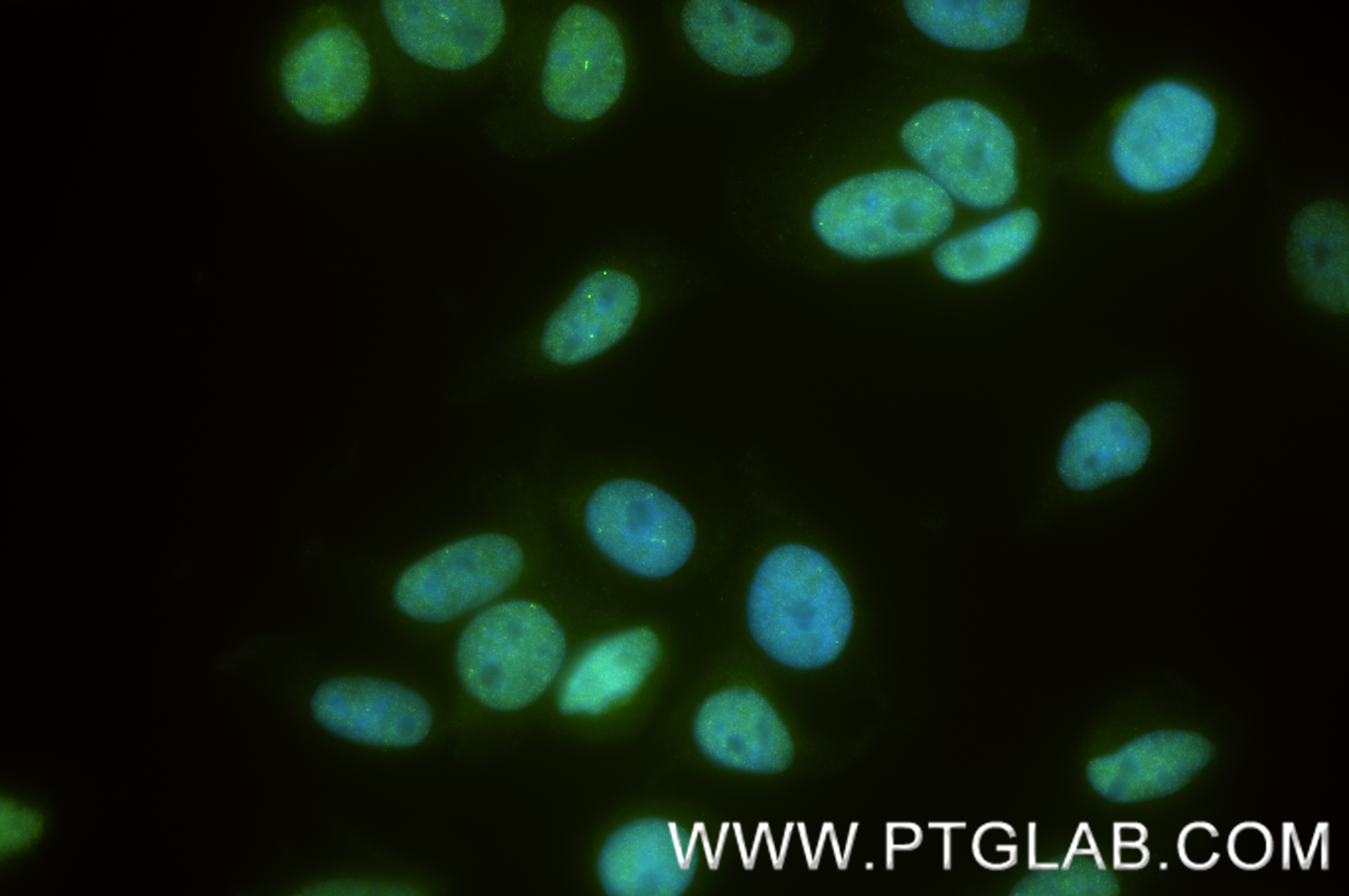 IF Staining of HepG2 using 88289-2-RR IF Staining of HepG2 using 88289-2-RR
