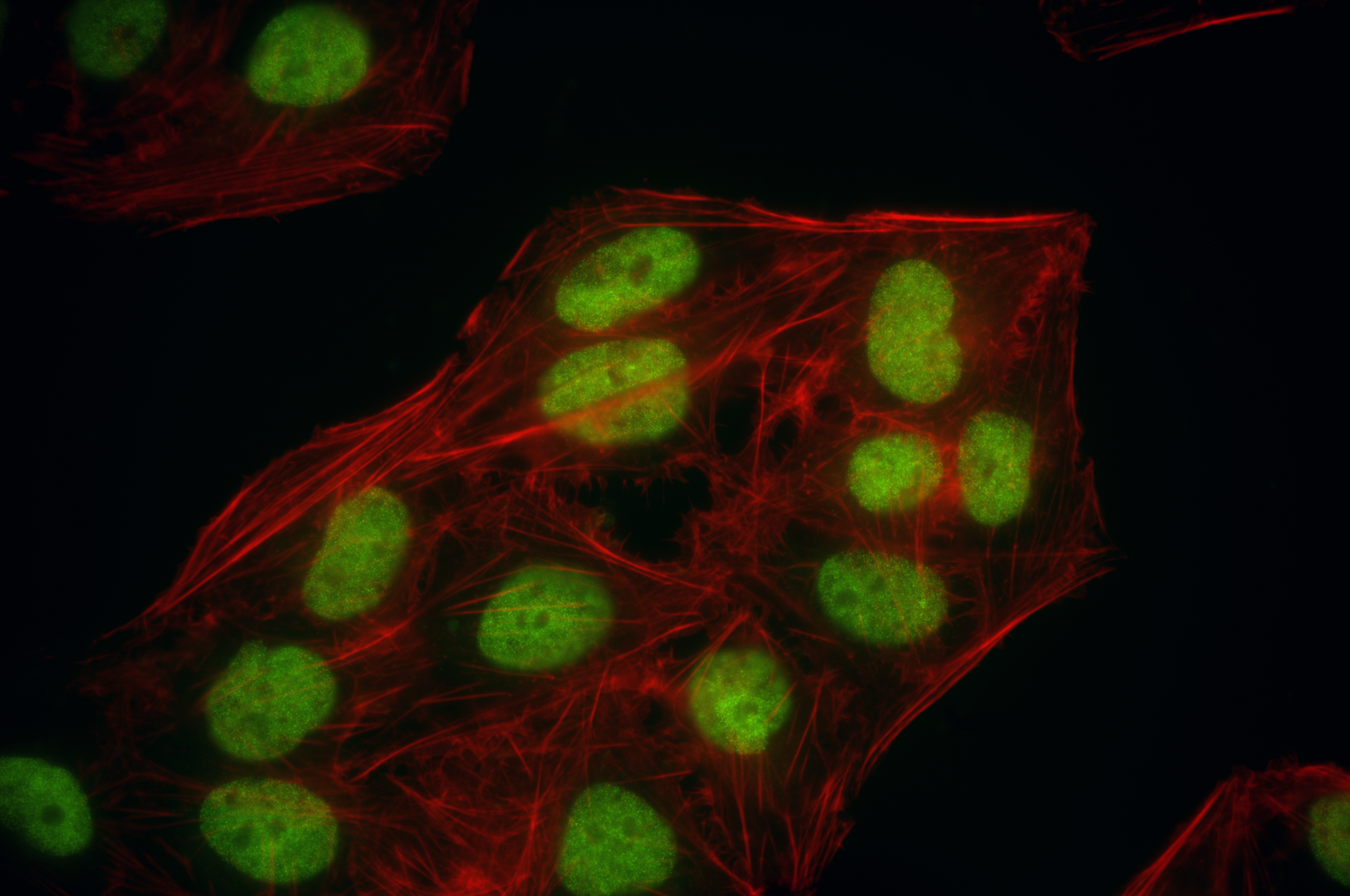 IF Staining of U2OS using 86176-1-RR