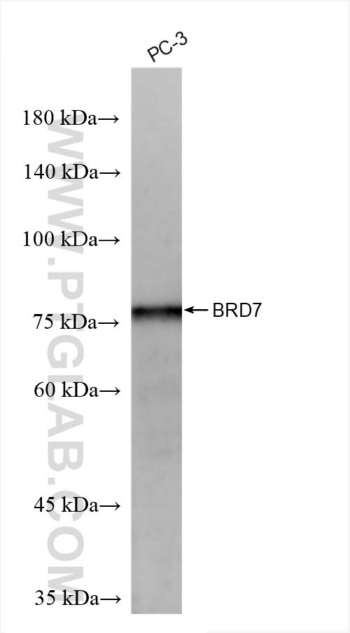 WB analysis of PC-3 using 86176-2-RR