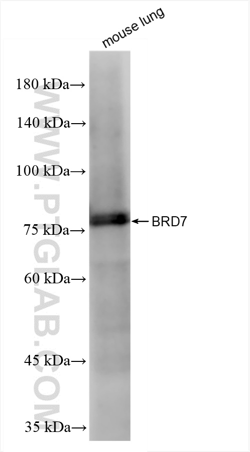 WB analysis of mouse lung using 86176-2-RR