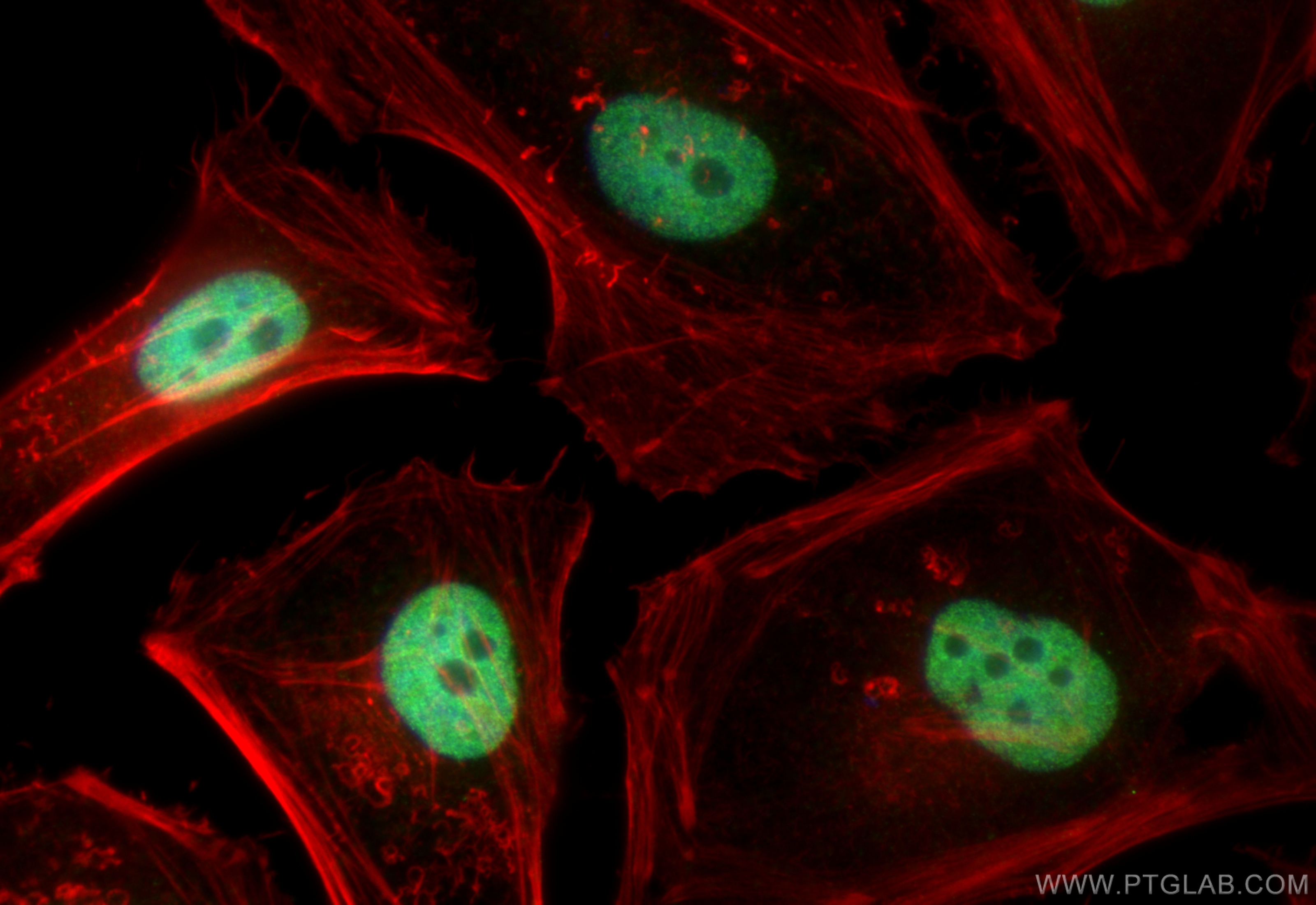 IF Staining of HeLa using 10476-1-AP