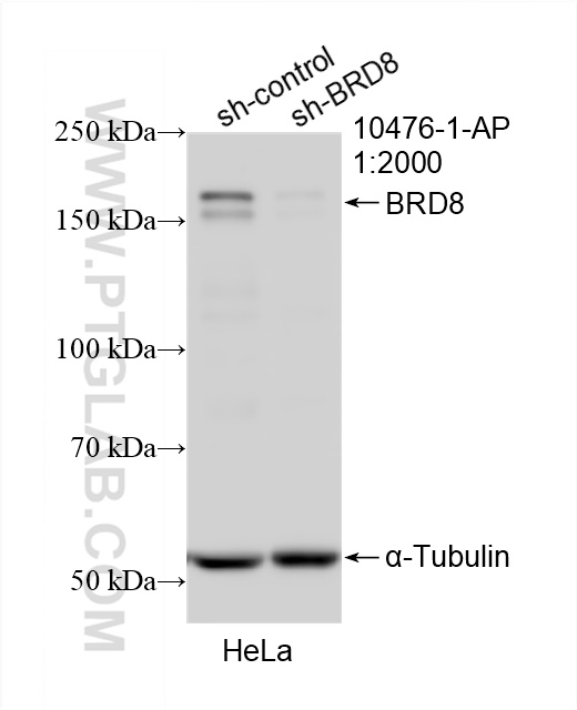 WB analysis of HeLa using 10476-1-AP