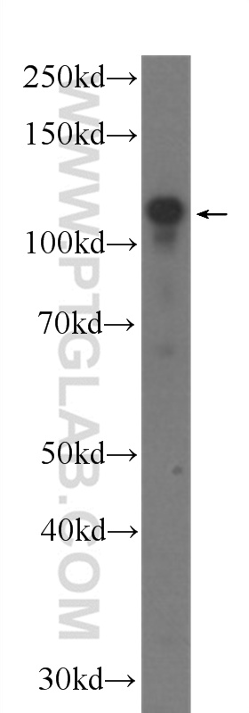 WB analysis of fetal human brain using 60121-1-Ig