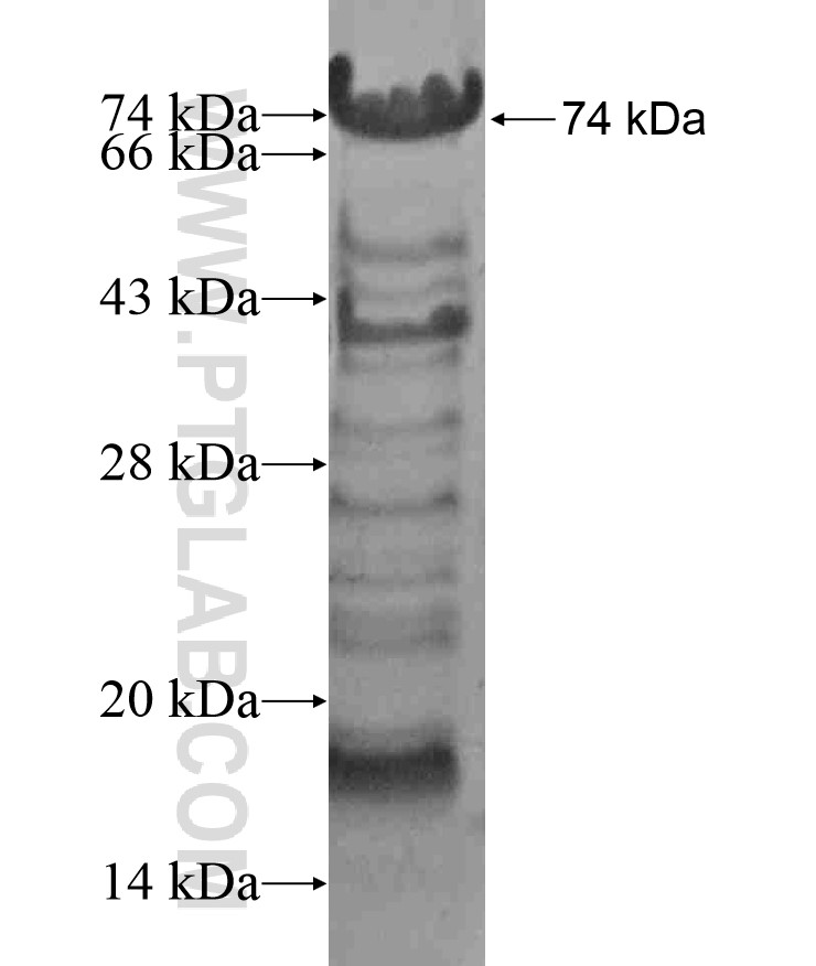 BRD8 fusion protein Ag17062 SDS-PAGE BRD8 fusion protein Ag17062 SDS-PAGE